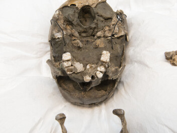 Viste Boy's jawbone and skull. (Photo: Terje Tveit, The Museum of Archaeology, University of Stavanger) Viste Boy's jawbone and skull. (Photo: Terje Tveit, The Museum of Archaeology, University of Stavanger)