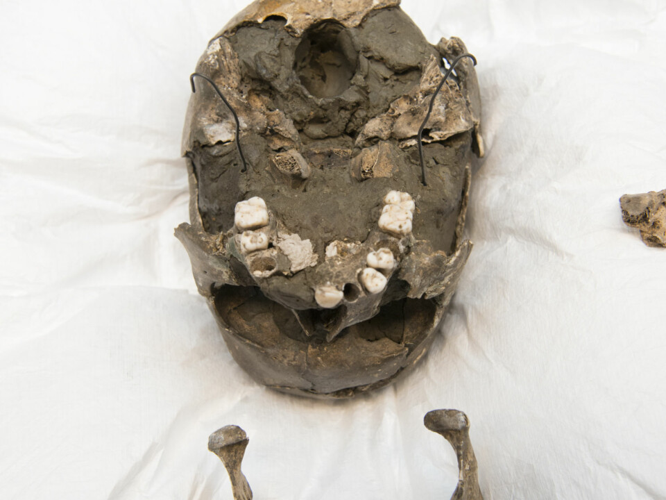 Viste Boy's jawbone and skull. (Photo: Terje Tveit, The Museum of Archaeology, University of Stavanger)