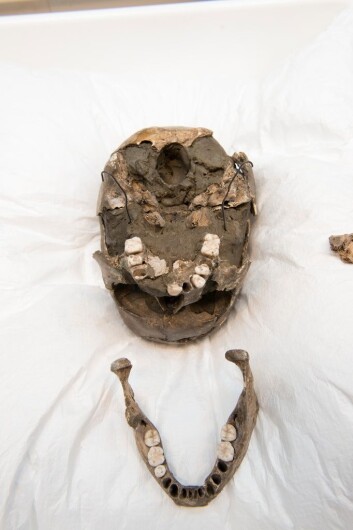 Kjeven og hodeskallen til Vistegutten. Et lite beinfragment på baksiden av hodeskallen er nå sendt til Sverige for DNA-analyse.
Dette og resten av skjelettet skal osteoarkeolog Sean D. Denham og konservator Hege Hollund ved Arkeologisk museum, Universitetet i Stavanger se nærmere på i løpet av høsten.
(Foto: Terje Tveit, Arkeologisk museum, Universitetet i Stavanger) Kjeven og hodeskallen til Vistegutten. Et lite beinfragment på baksiden av hodeskallen er nå sendt til Sverige for DNA-analyse.
Dette og resten av skjelettet skal osteoarkeolog Sean D. Denham og konservator Hege Hollund ved Arkeologisk museum, Universitetet i Stavanger se nærmere på i løpet av høsten.
(Foto: Terje Tveit, Arkeologisk museum, Universitetet i Stavanger)