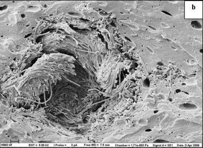Forlengede bakterier orientert rundt en fettkule i ost. Fettet er fjernet. (Foto: Martinovic et al.) Forlengede bakterier orientert rundt en fettkule i ost. Fettet er fjernet. (Foto: Martinovic et al.)