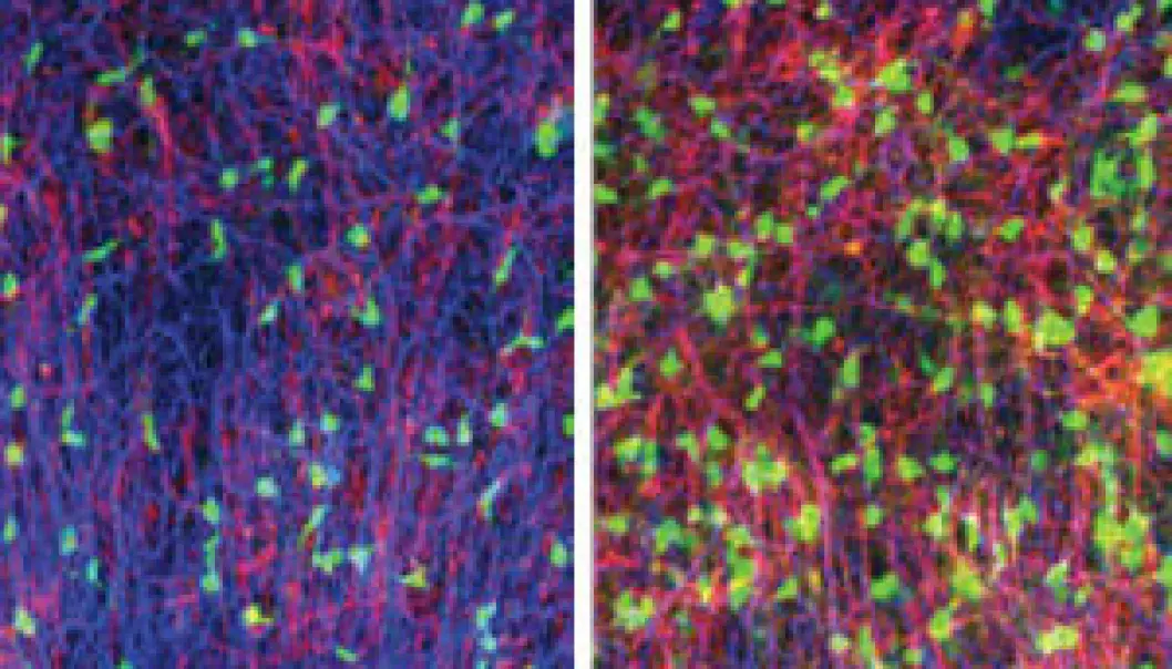 The image to the left shows that brain slices from mouse grown in physiological concentrations og sugar had an unormal small amount of myelin (red-pink colour). The right side image shows that when adding lactic acid the amount of myelin increased to a normal level. (Photo: Johanne E. Rinholm.)