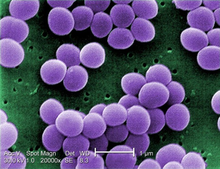 Staphylococcus aureus er en bakterie som dør ved varmebehandling. Men bakterien skiller ut et giftstoff som ikke lar seg fjerne hverken ved steking eller koking. (Foto: Centers for Disease Control and Prevention.) Staphylococcus aureus er en bakterie som dør ved varmebehandling. Men bakterien skiller ut et giftstoff som ikke lar seg fjerne hverken ved steking eller koking. (Foto: Centers for Disease Control and Prevention.)