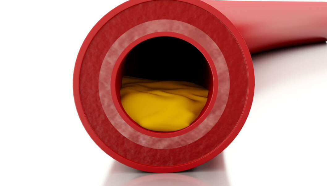 (Illustration: Colourbox.) (Illustration: Colourbox.)