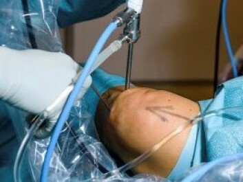 A reduction in the number of arthroscopic procedures for meniscus injuries could lead to substantial savings. (Photo: Øystein Horgmo, UiO) A reduction in the number of arthroscopic procedures for meniscus injuries could lead to substantial savings. (Photo: Øystein Horgmo, UiO)