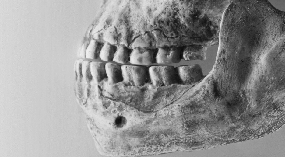 Neandertalere brukte tannpirkere til smertelindring