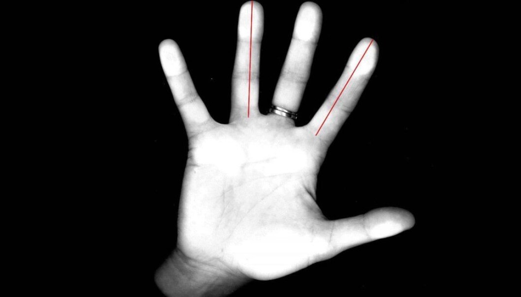Researchers used a common photocopy machine to measure the lengths of the index and ring fingers of 42 women. Half of these women were asked to solve different mental tasks after they had been given a drop of testosterone on their tongue. The goal was to determine the differences in how men's and women's brains work, and the significance of finger length and testosterone levels. (Photo: Carl Pintzka / Kolbjørn Skarpnes, NTNU) Researchers used a common photocopy machine to measure the lengths of the index and ring fingers of 42 women. Half of these women were asked to solve different mental tasks after they had been given a drop of testosterone on their tongue. The goal was to determine the differences in how men's and women's brains work, and the significance of finger length and testosterone levels. (Photo: Carl Pintzka / Kolbjørn Skarpnes, NTNU)