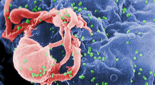 HIV-lignende virus mye eldre enn antatt
