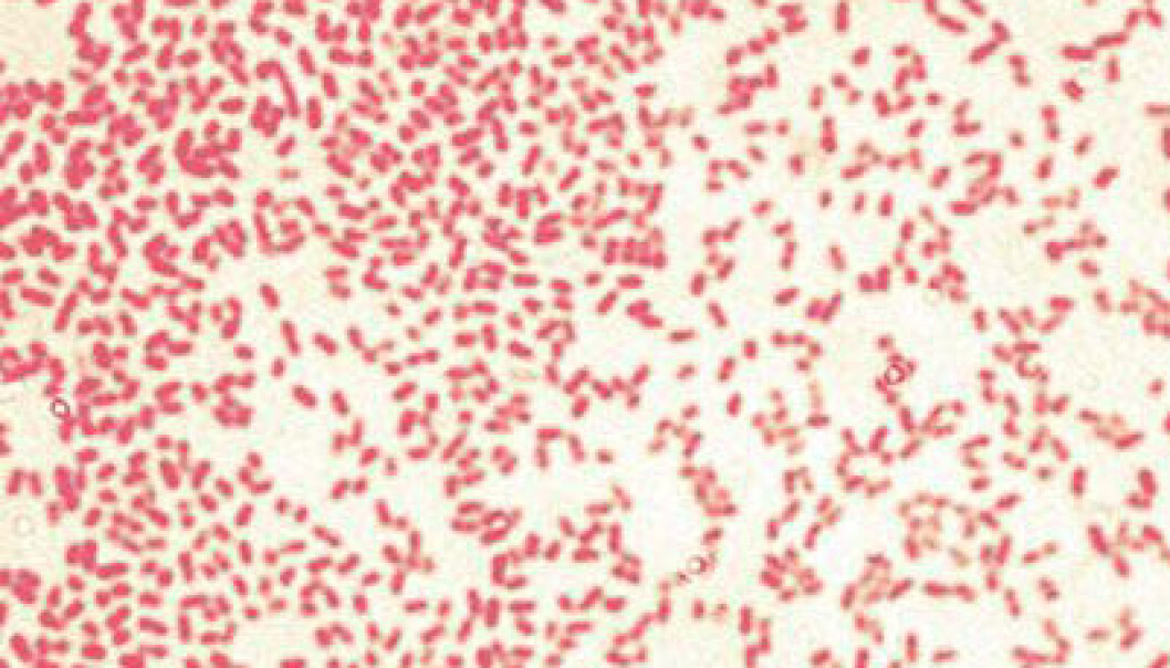 Bakterien Pseudomonas aeruginosa finnes i jord, vann og på huden. Den kan føre til farlige infeksjoner hos dyr og mennesker, blant annet blodforgiftning. (Bilde: Y_tambe, <a href="http://en.wikipedia.org/wiki/en:GNU_Free_Documentation_License">Wikimedia Commons</a>) Bakterien Pseudomonas aeruginosa finnes i jord, vann og på huden. Den kan føre til farlige infeksjoner hos dyr og mennesker, blant annet blodforgiftning. (Bilde: Y_tambe, <a href="http://en.wikipedia.org/wiki/en:GNU_Free_Documentation_License">Wikimedia Commons</a>)