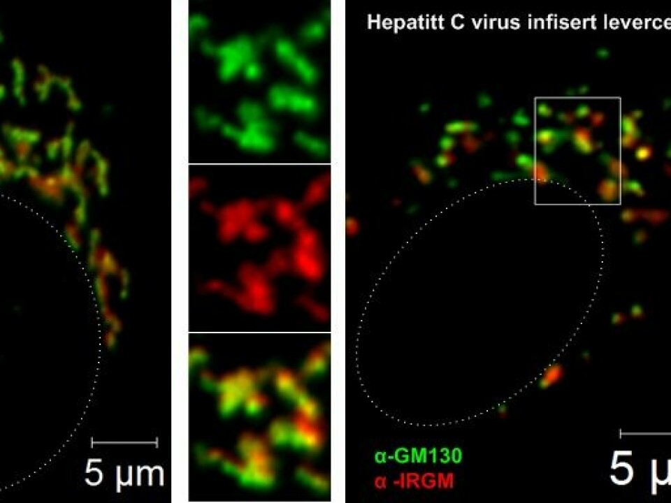 The image on the left shows a liver cell that is not infected with hepatitis C. The membrane sacs (green) and the protein IRGM in these (red) have an oblong structure. The image on the right shows a liver cell infected with hepatitis C. Here the virus has changed the cell membrane sacs (green) and the protein IRGM in these (red) to smaller sphere-shaped sacs. The hepatitis C virus takes over these smaller sacs, which then function as virus replication factories. The dotted white line in the pictures denotes the nuclear membrane, which contain cells that carry the liver cell’s genetic material. (Photo: Marianne Doré Hansen and Marit Anthonsen)