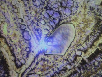 This image actually shows part of a pig's intestine. (Photo: Liv R. Bjergene) This image actually shows part of a pig's intestine. (Photo: Liv R. Bjergene)