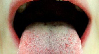 Peanøtt under tunga mot allergi