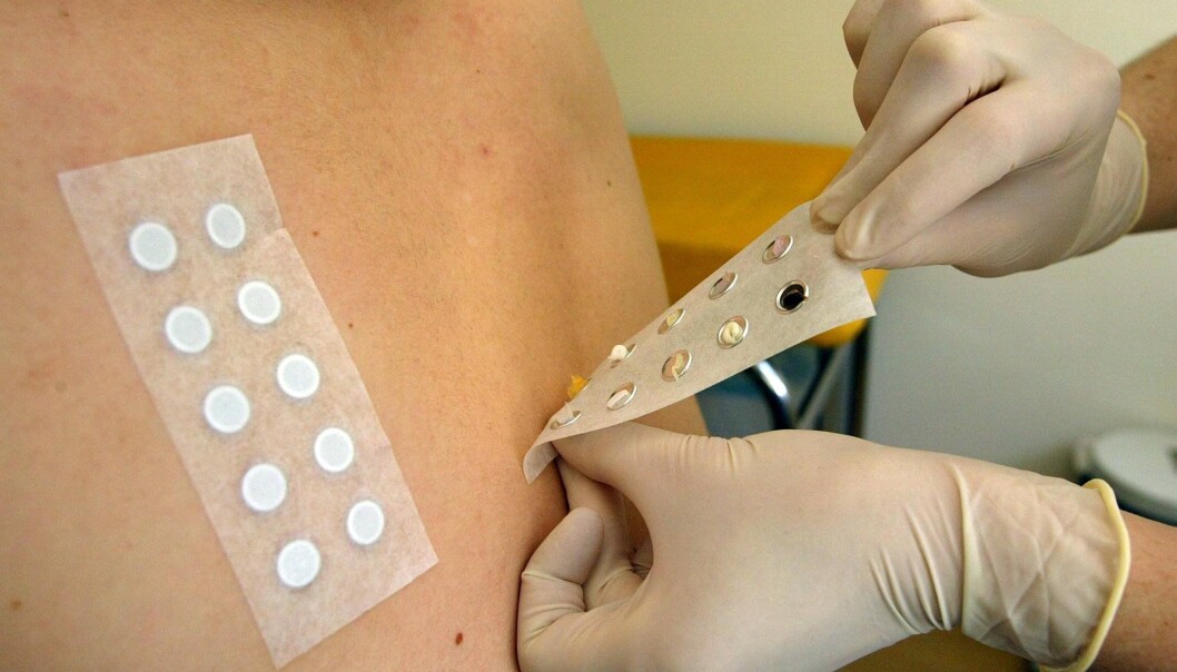 The skin plays a far more important role in the development of allergies than scientists previously believed. (Illustration: Colourbox.com) The skin plays a far more important role in the development of allergies than scientists previously believed. (Illustration: Colourbox.com)