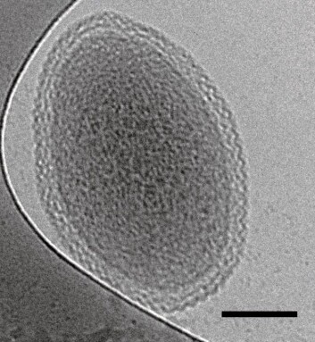 Bilde av en bitteliten bakteriecelle, tatt ved hjelp av elektronmikroskopi. Linjen som viser skalaen er 100 nanometer lang. (Foto: Birgit Luef, UC Berkeley, NTNU) Bilde av en bitteliten bakteriecelle, tatt ved hjelp av elektronmikroskopi. Linjen som viser skalaen er 100 nanometer lang. (Foto: Birgit Luef, UC Berkeley, NTNU)