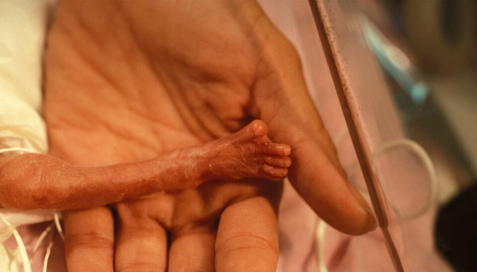 There are more than 200 babies born prematurely in Norway each year. These babies usually weigh 1000 grams or less, and it is almost scary to see their small body parts covered with transparent skin. Many of these premature babies survive thanks to an enormous effort to provide them medical treatment. (Photo: Colourbox)