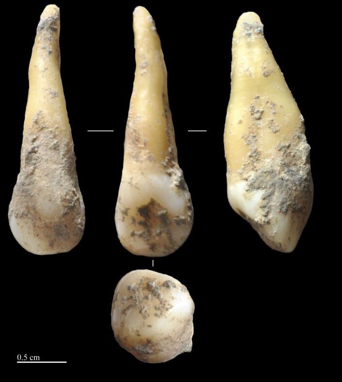 Forskerne analyserte DNA fra forhistoriske mennesketenner funnet under arkeologiske utgravinger. Disse 7400 år gamle tennene ble funnet i Vallirana nær Barcelona. (Foto: Joan Daura/Montserrat Sanz) Forskerne analyserte DNA fra forhistoriske mennesketenner funnet under arkeologiske utgravinger. Disse 7400 år gamle tennene ble funnet i Vallirana nær Barcelona. (Foto: Joan Daura/Montserrat Sanz)