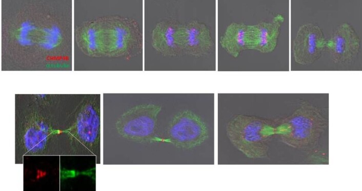 – Proteinene klemmer også sammen hullene etter kablene, slik at hinnen rundt DNA-et kan stenges igjen – omtrent slik lukkemekanismen i et kamera fungerer. Da etterlater de en glatt og fin membran, uten kabler eller heslige hull som molekyler kan passere igjennom, forklarer Stenmark. (Foto: Marina Vietri) – Proteinene klemmer også sammen hullene etter kablene, slik at hinnen rundt DNA-et kan stenges igjen – omtrent slik lukkemekanismen i et kamera fungerer. Da etterlater de en glatt og fin membran, uten kabler eller heslige hull som molekyler kan passere igjennom, forklarer Stenmark. (Foto: Marina Vietri)