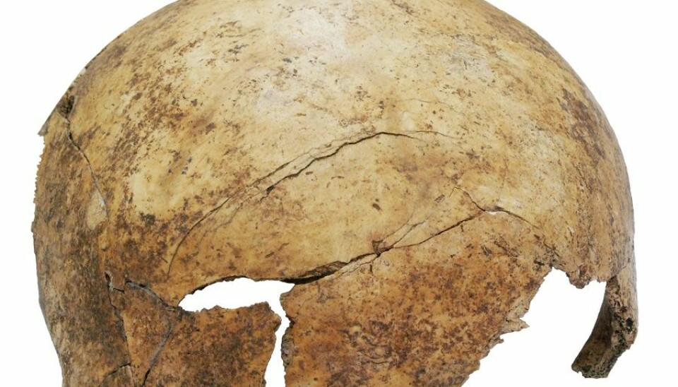 Blant funnene i massegraven er denne hodeskallen med tydelige skader. Den tilhørte en åtteåring. (Foto: Christian Meyer)
