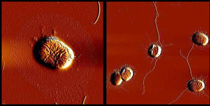 E. coli-bakterien har gener som koder for trådlignende strukturer. Disse trådene gjør det enklere for bakterien å feste seg til overflater. Genene må være aktive for at bakteriene skal lage disse trådene, og de blir aktive gjennom at de kommuniserer. Det Tiofenon gjør er å forstyrre kommunikasjonen. Slik hindrer de at genene blir aktivert, og dermed blir heller ikke trådene produsert. E. coli får da vanskeligere for å feste seg og danne biofilm. Til venstre ser vi en E. coli- bakterie som har blitt tilført Tiofenon. Som vi ser mangler det en trådlignende struktur. Til sammenligning ser vi på bildet til høyre bakterier som ikke er behandlet med Tiofenon, og har produsert vanlige tråder. (Foto: Ida Hegna, Farmasøytisk instiutt, UiO) E. coli-bakterien har gener som koder for trådlignende strukturer. Disse trådene gjør det enklere for bakterien å feste seg til overflater. Genene må være aktive for at bakteriene skal lage disse trådene, og de blir aktive gjennom at de kommuniserer. Det Tiofenon gjør er å forstyrre kommunikasjonen. Slik hindrer de at genene blir aktivert, og dermed blir heller ikke trådene produsert. E. coli får da vanskeligere for å feste seg og danne biofilm. Til venstre ser vi en E. coli- bakterie som har blitt tilført Tiofenon. Som vi ser mangler det en trådlignende struktur. Til sammenligning ser vi på bildet til høyre bakterier som ikke er behandlet med Tiofenon, og har produsert vanlige tråder. (Foto: Ida Hegna, Farmasøytisk instiutt, UiO)