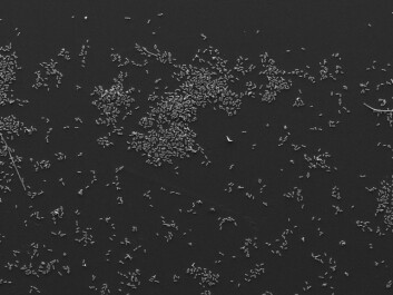 Bilde viser bakterier som har blitt tilsatt Tiofenon. Bildene tydeliggjør den vesentlige forskjellen i mengde biofilm som bakteriene danner med og uten tilførsel av Tiofenon. (Foto: Steinar Stølen) Bilde viser bakterier som har blitt tilsatt Tiofenon. Bildene tydeliggjør den vesentlige forskjellen i mengde biofilm som bakteriene danner med og uten tilførsel av Tiofenon. (Foto: Steinar Stølen)