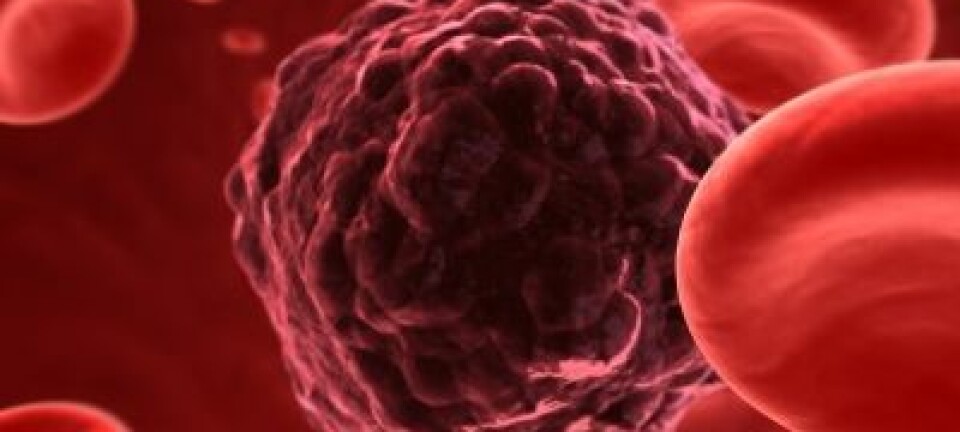 Forskere foreslår at kreft skyldes endringer i vevet i kroppen, som gjør at kreftceller kan utkonkurrere friske celler. Det er ny måte å oppfatte kreft på. (Illustrasjon: iStockphoto)
