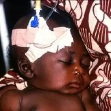 "Baby med malaria.(Foto: WHO/Pierre Virot)" (Foto: WHO/Pierre Virot)
