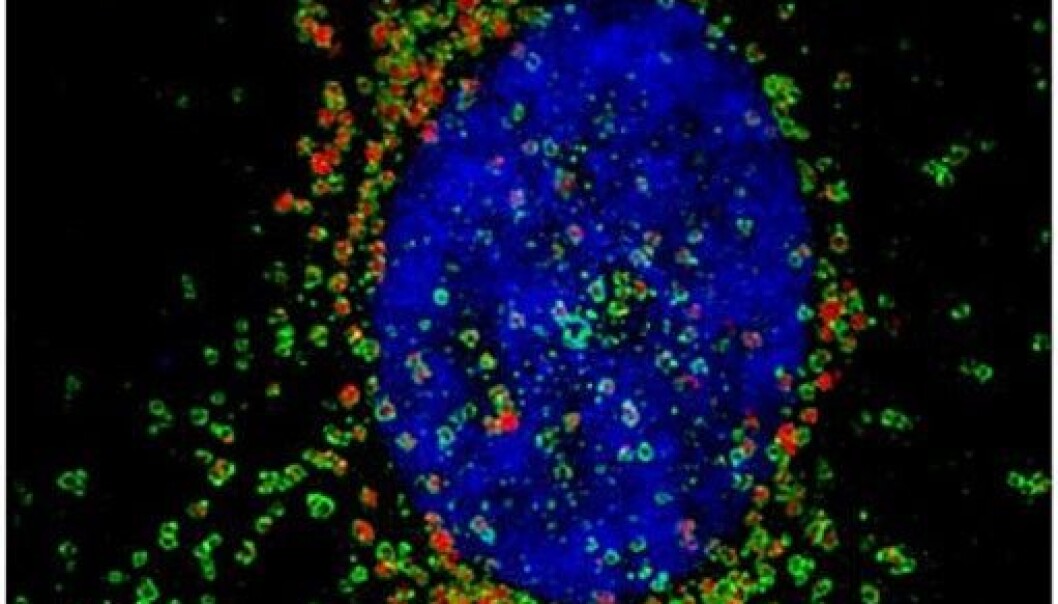 En kreftcelle har tatt opp fluorescerende nanopartikler (i rødt). En stor andel av nanopartiklene ender opp inne i de små blærene som bryter ned store molekyler kalt lysosomer ( i grønt). (Foto: UiO) En kreftcelle har tatt opp fluorescerende nanopartikler (i rødt). En stor andel av nanopartiklene ender opp inne i de små blærene som bryter ned store molekyler kalt lysosomer ( i grønt). (Foto: UiO)