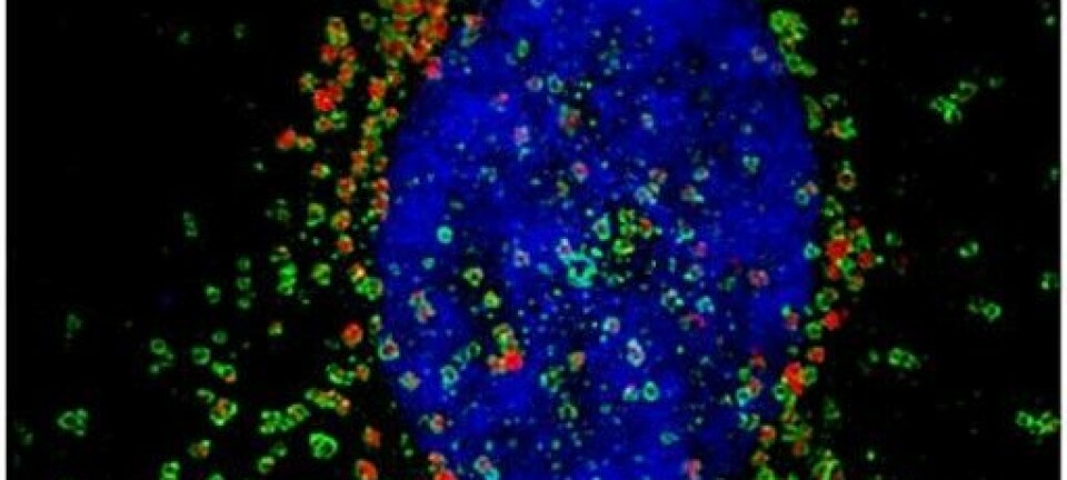 En  kreftcelle har tatt opp fluorescerende nanopartikler (i rødt). En stor andel av nanopartiklene ender opp inne i de små blærene som bryter ned store molekyler kalt lysosomer ( i grønt). (Foto: UiO)