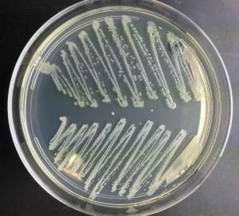 Bakterier fra nesen. Øverst er det koli-bakterier, nederst stafylokokker.  (Foto: Sally Statham, TG-en)