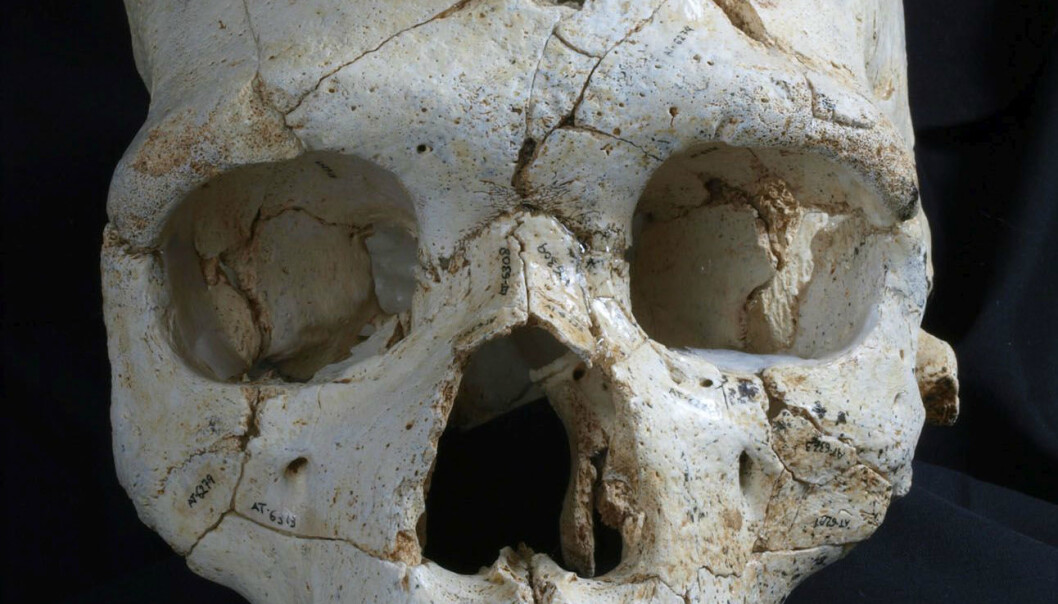 Hodeskallen med navnet Kranium 17 har to dype hull over det venstre øyet. Mord, mener forskere. ( Foto: Javier Trueba, Madrid Scientific Films) Hodeskallen med navnet Kranium 17 har to dype hull over det venstre øyet. Mord, mener forskere. ( Foto: Javier Trueba, Madrid Scientific Films)