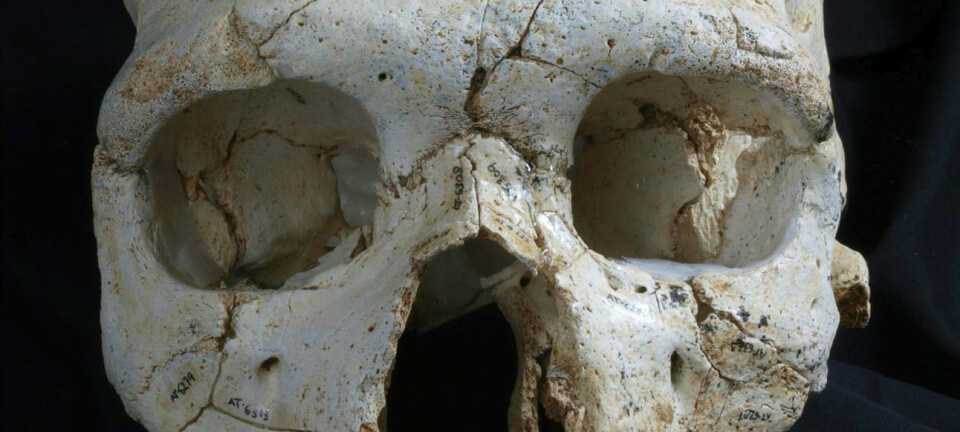 Hodeskallen med navnet Kranium 17 har to dype hull over det venstre øyet. Mord, mener forskere. ( Foto: Javier Trueba, Madrid Scientific Films)