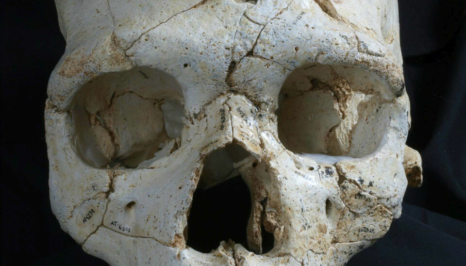 Hodeskallen med navnet Kranium 17 har to dype hull over det venstre øyet. Mord, mener forskere. ( Foto: Javier Trueba, Madrid Scientific Films)