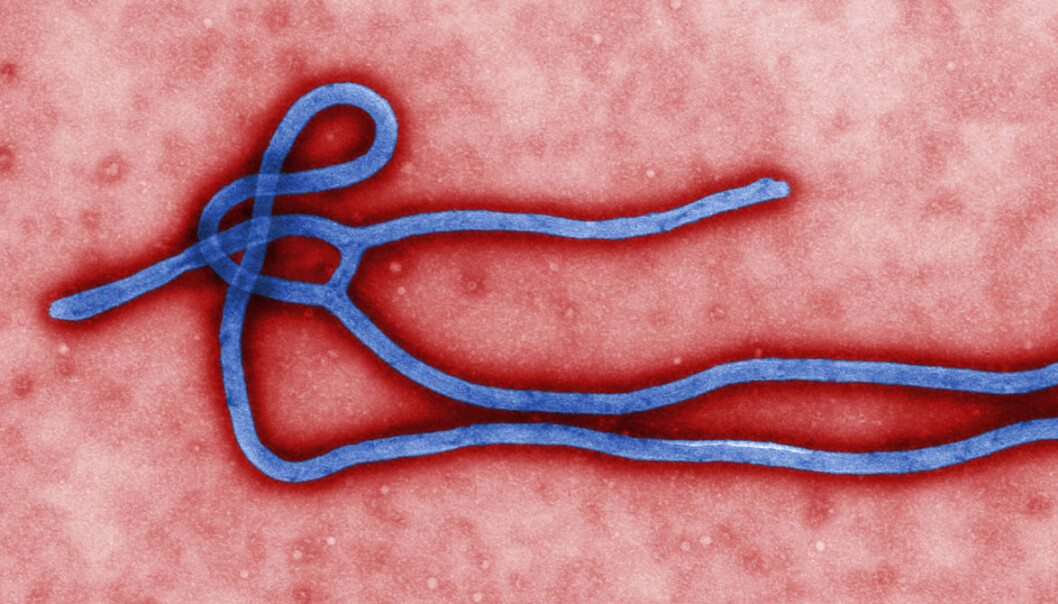 Ebolaviruset er avhengig av et protein for å klare å trenge ut i cellen. Forskere har klart å blokkere dette proteinet ved å endre arvestoffet til laboratoriemus. (Elektronmikroskopi: Centers for Disease Control and Prevention's Public Health Image Library.) Ebolaviruset er avhengig av et protein for å klare å trenge ut i cellen. Forskere har klart å blokkere dette proteinet ved å endre arvestoffet til laboratoriemus. (Elektronmikroskopi: Centers for Disease Control and Prevention's Public Health Image Library.)