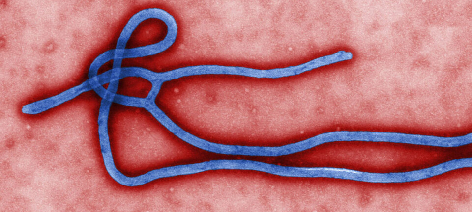 Ebolaviruset er avhengig av et protein for å klare å trenge ut i cellen. Forskere har klart å blokkere dette proteinet ved å endre arvestoffet til laboratoriemus. (Elektronmikroskopi:  Centers for Disease Control and Prevention's Public Health Image Library.)