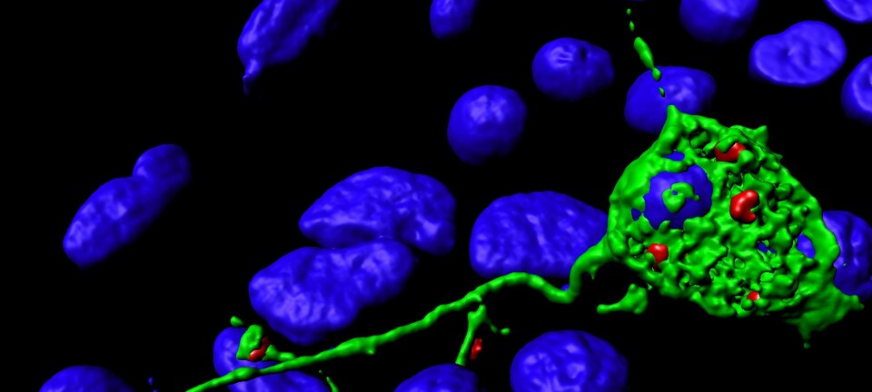 Et mikroskopibilde av en nervecelle (grønn). Blærer (rødt) samler seg i tuppen av nervetrådene før de smelter sammen med cellemembranen og bidrar til at nervetrådene vokser videre. Cellekjerner (DNA) ses i blått. (Foto: Camilla Raiborg)