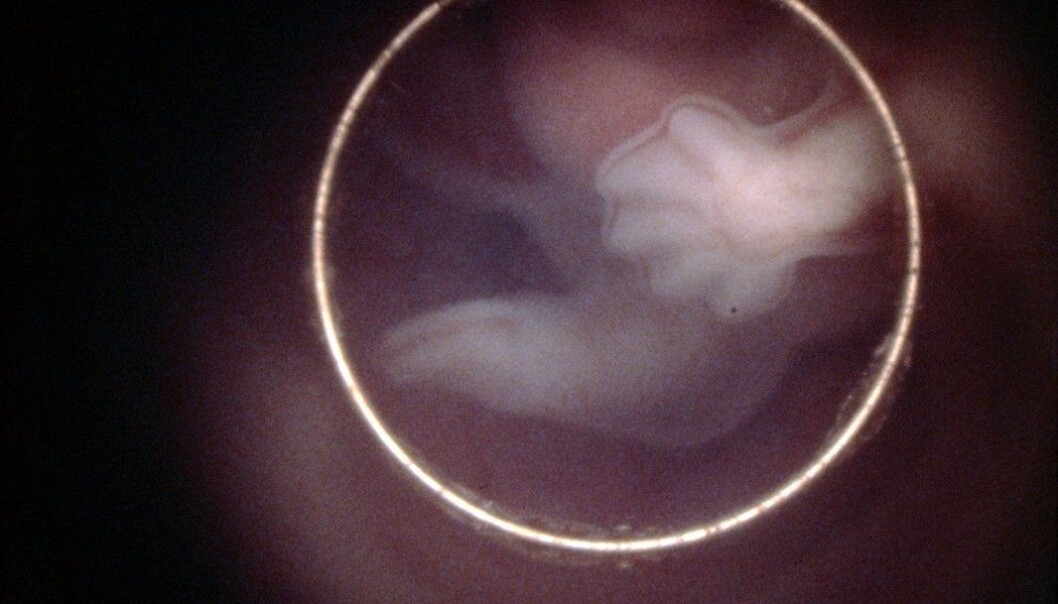 Fem uker gammelt menneskeembryo i livmoren. Nå ønsker forskere en stans i forskningen som kan genmanipulere fostre på dette stadiet. De mener vi vet for lite om mulige skadevirkninger for mennesket senere i livet. (Foto: Science Photo Library) Fem uker gammelt menneskeembryo i livmoren. Nå ønsker forskere en stans i forskningen som kan genmanipulere fostre på dette stadiet. De mener vi vet for lite om mulige skadevirkninger for mennesket senere i livet. (Foto: Science Photo Library)
