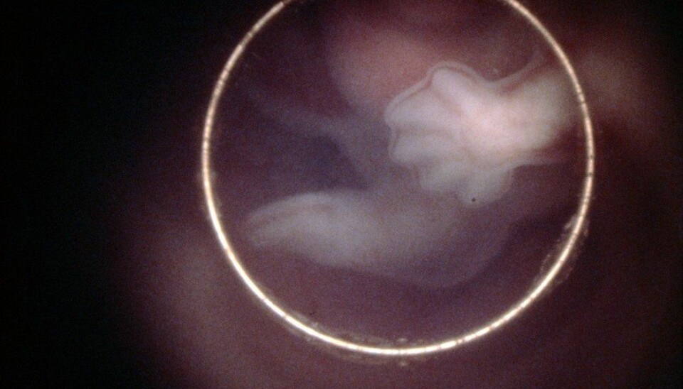 Fem uker gammelt menneskeembryo i livmoren. Nå ønsker forskere en stans i forskningen som kan genmanipulere fostre på dette stadiet. De mener vi vet for lite om mulige skadevirkninger for mennesket senere i livet. (Foto: Science Photo Library)