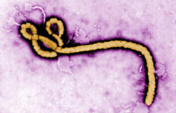Fargelagt avbildning av Ebola-virus ved hjelp av et elektronmikroskop. (Foto: CDC) (Foto: CDC) Fargelagt avbildning av Ebola-virus ved hjelp av et elektronmikroskop. (Foto: CDC) (Foto: CDC)
