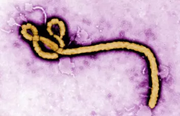 Fargelagt avbildning av Ebola-virus ved hjelp av et elektronmikroskop. (Foto: CDC) (Foto: CDC)