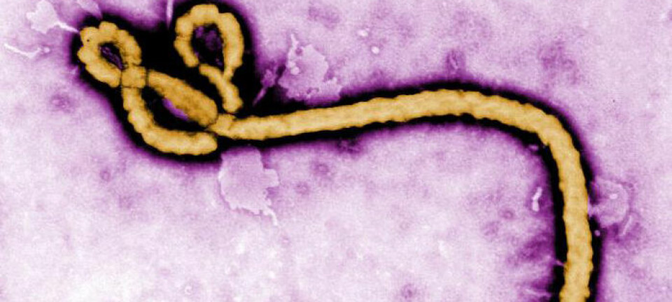 Fargelagt avbildning av ebola-virus ved hjelp av et elektronmikroskop. (Foto: CDC)