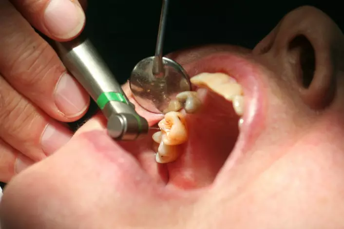 En av leserne våre lurer på hvorfor tennene våre ikke klarer seg uten tannlegebesøk. (Foto: www.colourbox.com) (Foto: Colourbox)