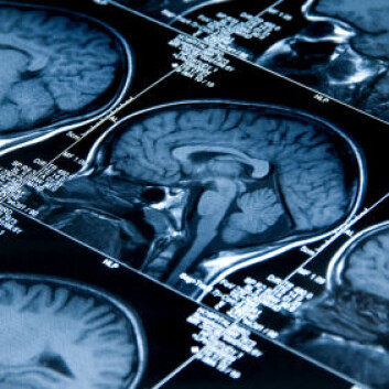 MRI av en hjerne. Hvor plastisk er den etter at den har blitt voksen?(Illustrasjonsfoto: iStockphoto) (Illustrasjonsfoto: iStockphoto) MRI av en hjerne. Hvor plastisk er den etter at den har blitt voksen?(Illustrasjonsfoto: iStockphoto) (Illustrasjonsfoto: iStockphoto)