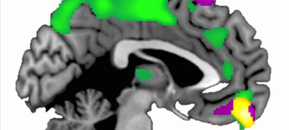 Den ventromediale prefrontale cortexen (gult område) er større hos mennesker som stoler på andre enn hos de mer mistenksomme. (Illustrasjon: Brian Haas, University of Georgia)