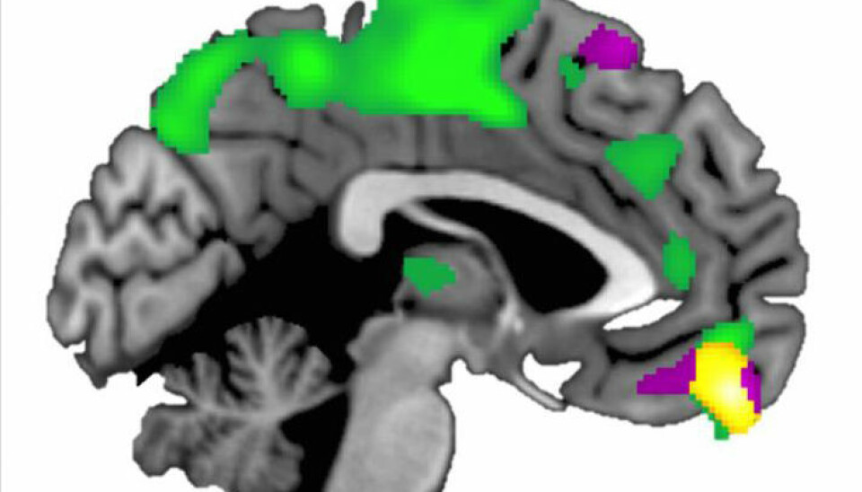 Den ventromediale prefrontale cortexen (gult område) er større hos mennesker som stoler på andre enn hos de mer mistenksomme. (Illustrasjon: Brian Haas, University of Georgia)