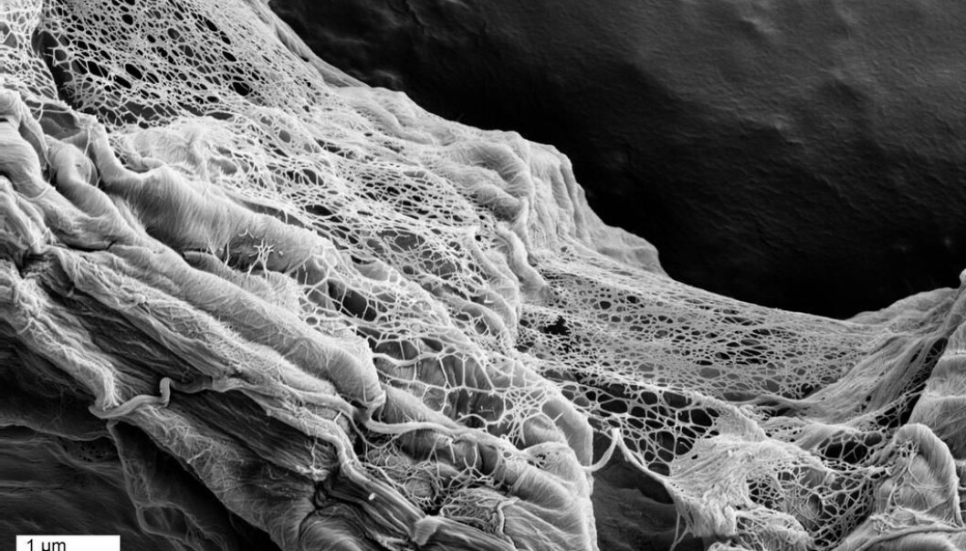 Bildet viser en sterk forstørrelse av såkalte nanofibriller av cellulose. De fleste fibrillene her har en diameter på cirka 15 nanometer. (Foto: Gary Chinga, Carrasco/PFI) Bildet viser en sterk forstørrelse av såkalte nanofibriller av cellulose. De fleste fibrillene her har en diameter på cirka 15 nanometer. (Foto: Gary Chinga, Carrasco/PFI)