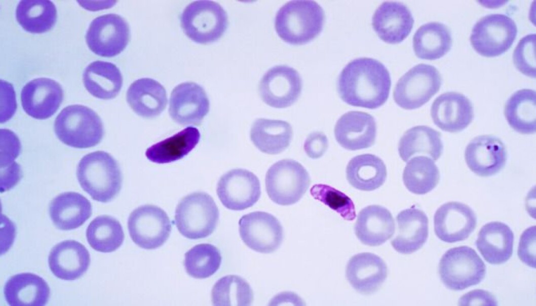 Malariaparasittar skil ut eit protein som lettare bind seg til blodtype A enn blodtype O. Biletet viser mikroskopbilete av malariaparasittar i blod. (Foto: Mae Melvin, Centers For Disease Control And Prevention's Public Health Image Library) Malariaparasittar skil ut eit protein som lettare bind seg til blodtype A enn blodtype O. Biletet viser mikroskopbilete av malariaparasittar i blod. (Foto: Mae Melvin, Centers For Disease Control And Prevention's Public Health Image Library)