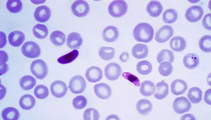 Har du blodtype O, er du meir beskytta mot malaria-død