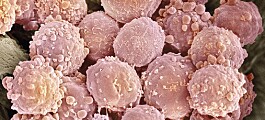 Ny kreftvaksine får immunforsvaret til å angripe kreft