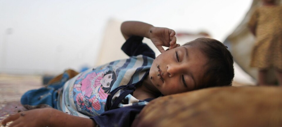 To millioner barn mellom ett og fire år dør årlig av diaré og lungebetennelse. Denne pakistanske ettåringen er hardt rammet av diaré. (Foto: Tim Wimborne/Reuters)