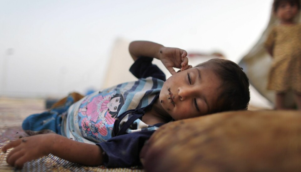 To millioner barn mellom ett og fire år dør årlig av diaré og lungebetennelse. Denne pakistanske ettåringen er hardt rammet av diaré. (Foto: Tim Wimborne/Reuters)