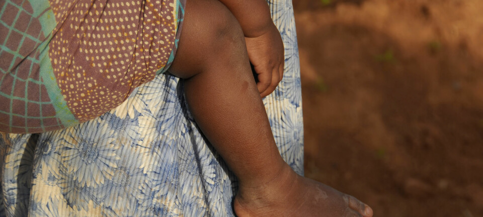 Jenter i Tanzania gifter seg og får barn i svært ung alder. Det gjør dem utsatt for komplikasjoner knyttet til fødsler og seksuelt overførbare sykdommer, og gir dem lite muligheter til å ta selvstendige valg. (Illustrasjonsfoto: Microstock)